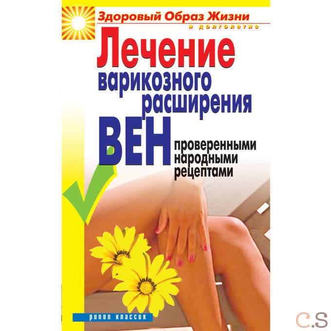 Лечение варикозного расширения вен проверенными народными рецептами